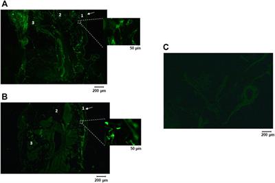 Cutaneous TRPV4 Channels Activate Warmth-Defense Responses in Young and Adult Birds